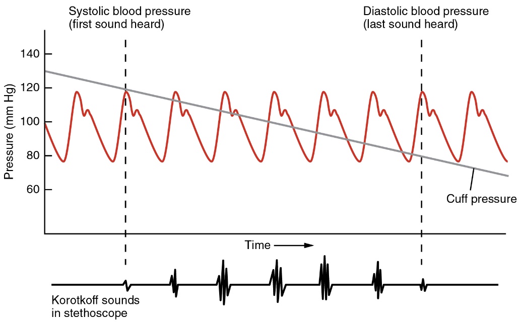 This image shows blood pressure as a function of time. A gray line demonstrates the change in cuff pressure when using a sphygmomanometer. A line represents the Korotkoff sounds heard in the stethoscope for the first sound heard (systolic blood pressure) and the last sound heard (diastolic blood pressure).