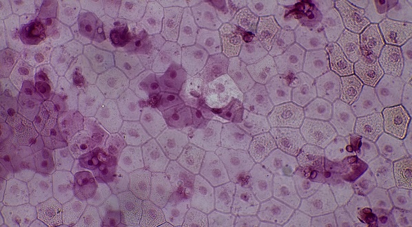 Histology image of simple squamous cells.