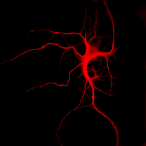A microscope image of a multipolar neuron from the cerebral cortex of a mouse, fluorescently labeled red.