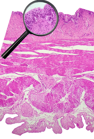Histology image of the urinary bladder. A magnifying glass is placed over the epithelium to show a more magnified view of the epithelial arrangement.

Description automatically generated