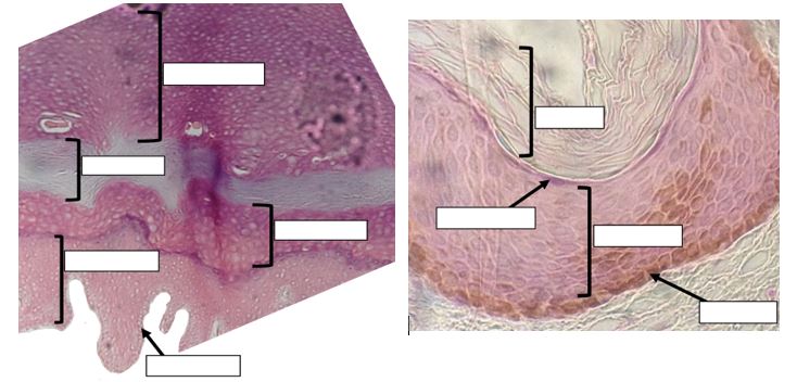 Two histology images of the epidermis. The image on the left has 5 unlabeled areas of strata indicated and the image on the right has 4 unlabeled areas of strata indicated.
