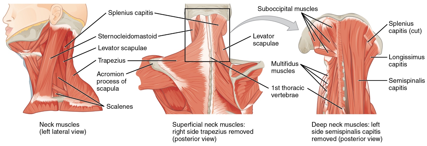 A diagram of the muscles of the neck and upper back, posterior and lateral views provided. Superficial muscles are shown first on the lateral neck and shoulders and then the deeper muscles are shown in the posterior view.