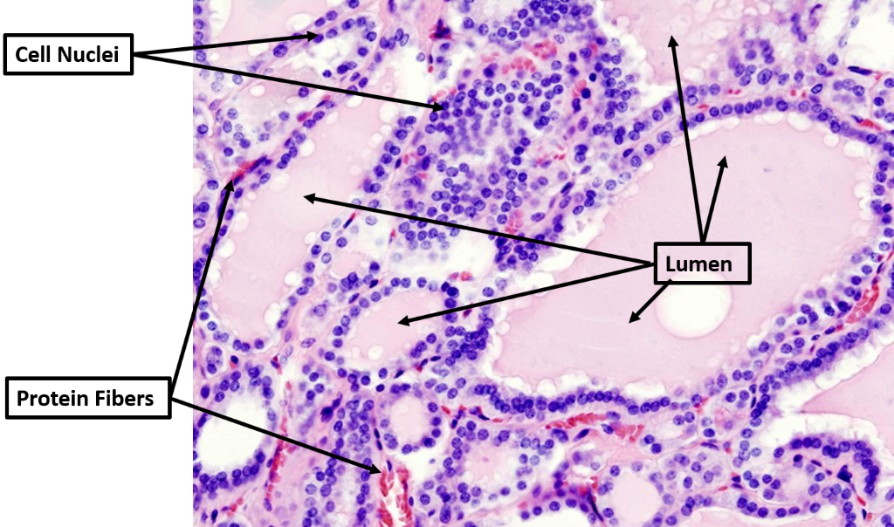 A microscope view of a human thyroid tissue with arrows indicating the cell nuclei, lumen, and protein fibers.

