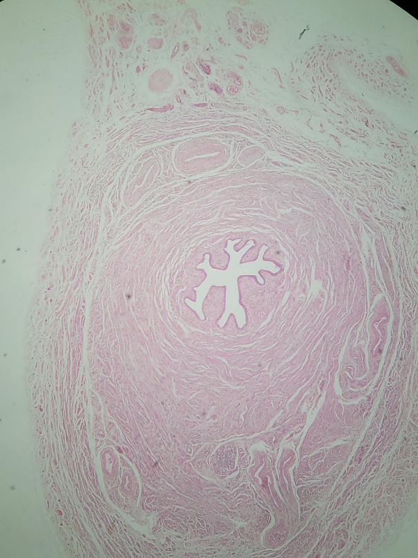 Histology image of the fallopian tubes with hematoxylin and eosin staining.