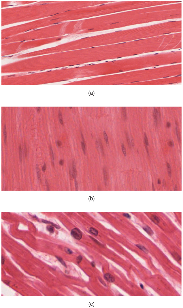 Three histology images of muscle. The first image shows a longitudinal section of skeletal muscle with peripheral nuclei visible. The second image shows a single nucleus in the middle of spindle shaped smooth muscle cells. The third image shows branched cardiac muscle cells with a  single nucleus per cell.
