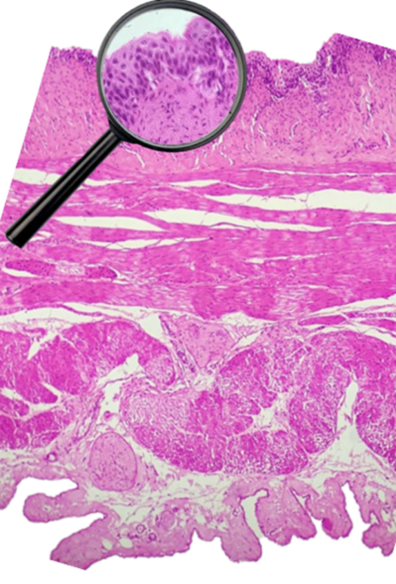 Histology image of the contracted bladder with a magnifying glass showing the magnified epithelial tissue.