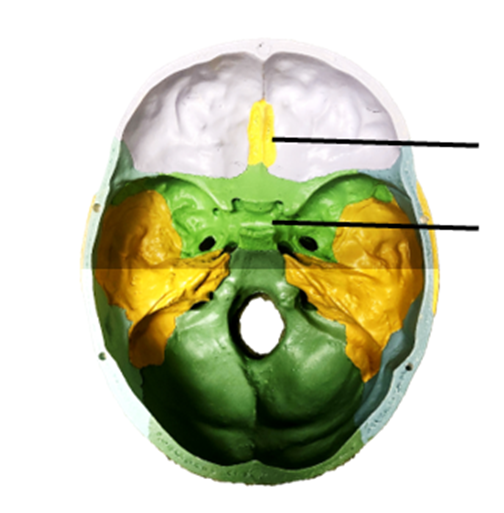 A view of the bones in the cranial cavity with the skull cap removed from the model. The skull bones have different colored parts and lines indicating what bones need to be labeled.