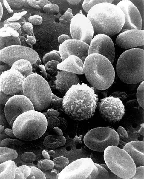 Microscopic image of a drop of blood taken from an electron scanning microscope. Variations in the formed elements of blood, sizes, and structures are captured in the image.