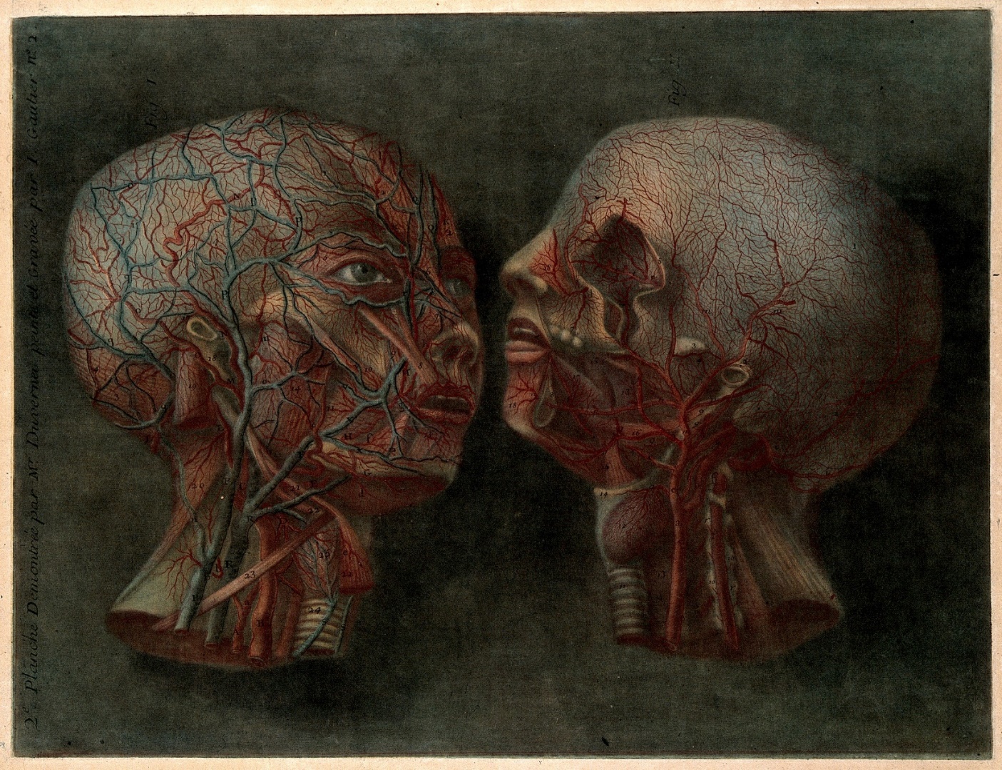 Artistic rendering of two heads with muscles removed to reveal the blood vessels of the head and neck. The head on the left is tilted to a lateral right side view. The head on the right is tilted for a left side lateral view but the left eye and left mandible have been removed in the image.
