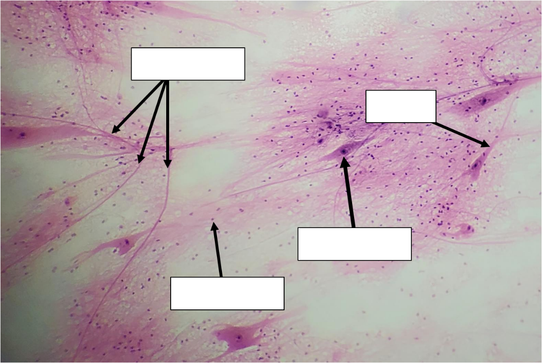 A low power microscope image of nervous tissue with arrows and blank boxes indicating the places that need to be identified and labeled. 