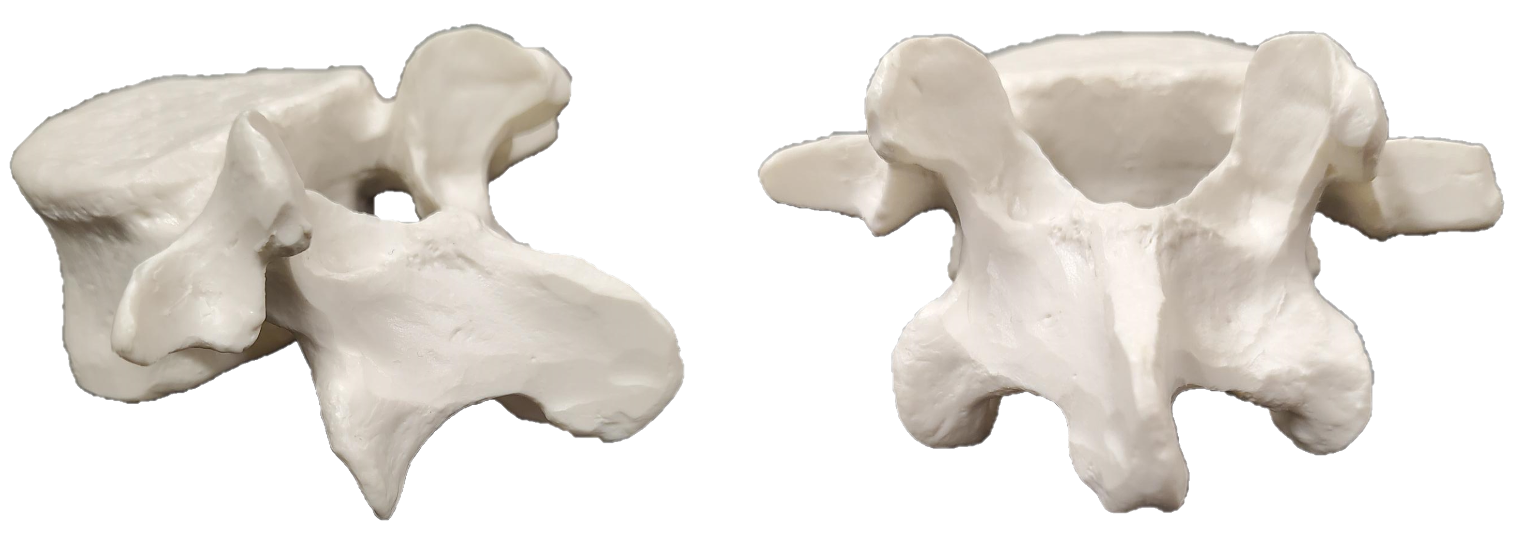 Lumbar vertebra viewed from the left lateral side and the posterior side.