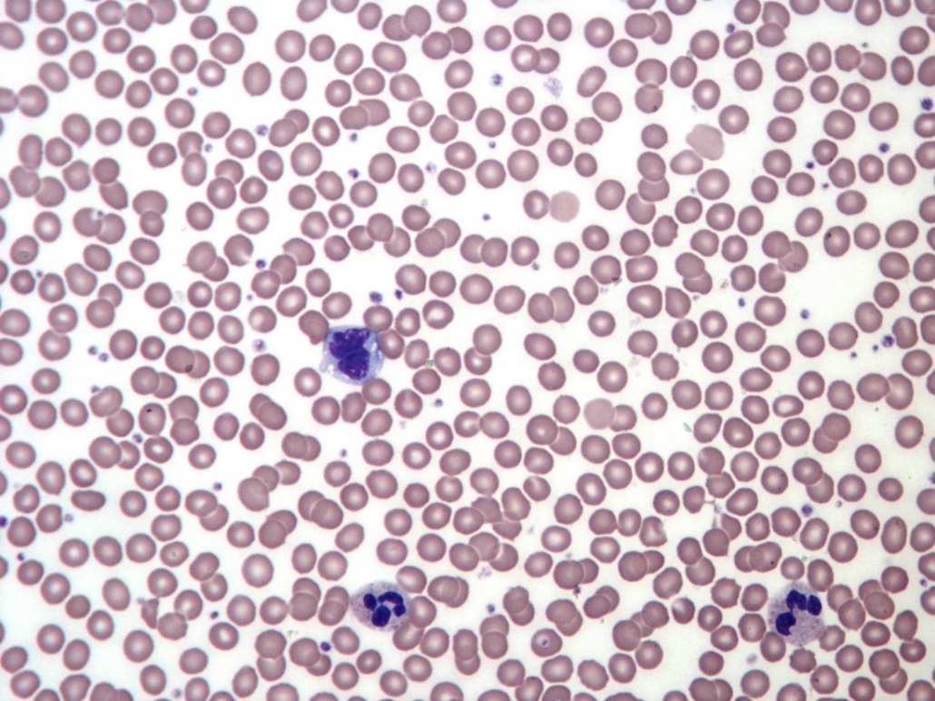 Blood was smeared onto a glass slide, stained with Giemsa and then imaged using a light microscope. A close-up of many red blood cells, three white blood cells, and several small platelets are visible.

Description automatically generated