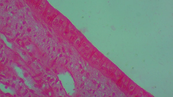 Histology image of simple columnar cells.