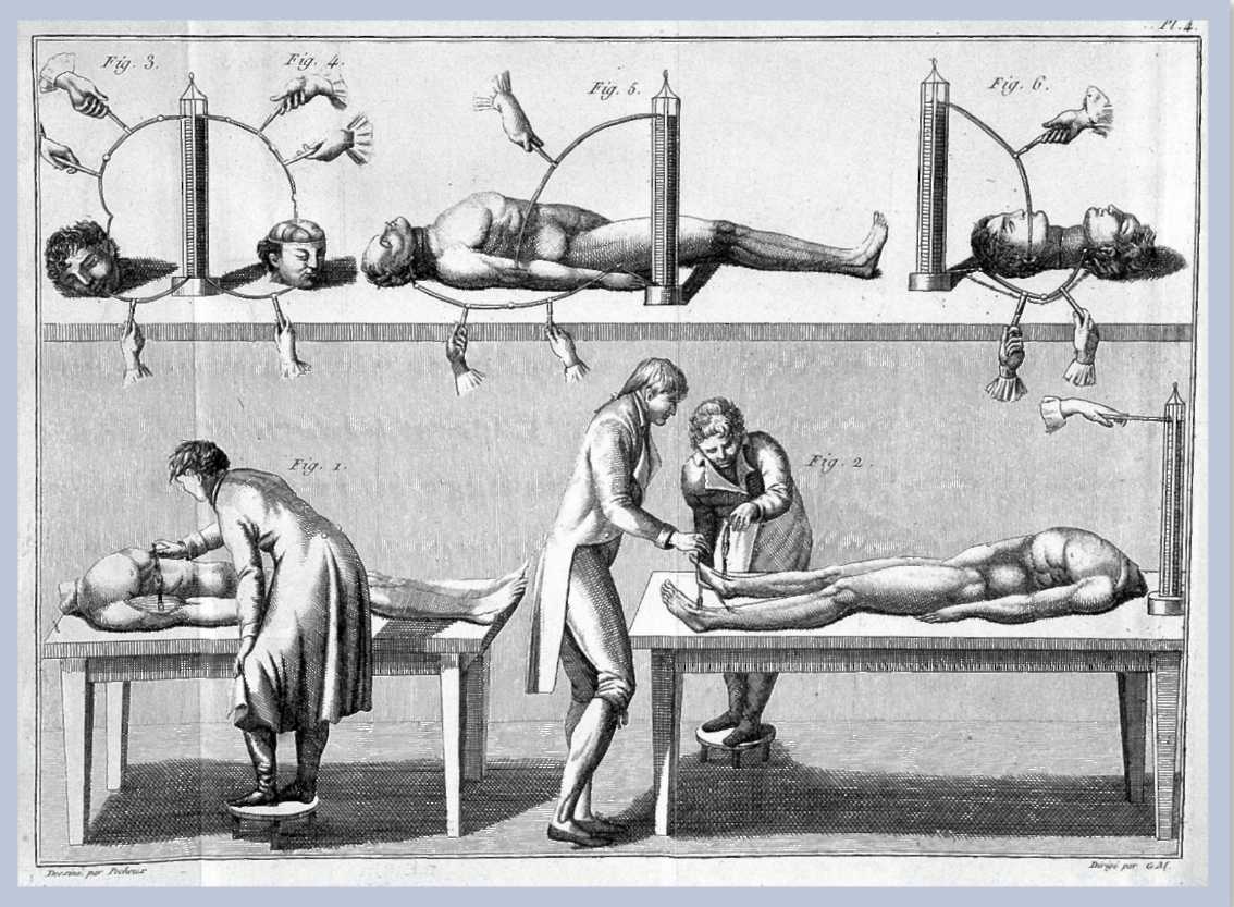 Experiments done by the removal of limbs and heads off of bodies.