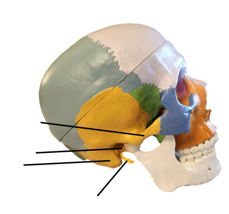 A skull model with parts of the temporal bone indicated by a line.