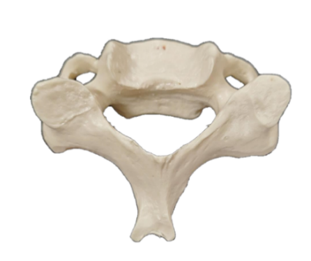 A typical cervical vertebra.