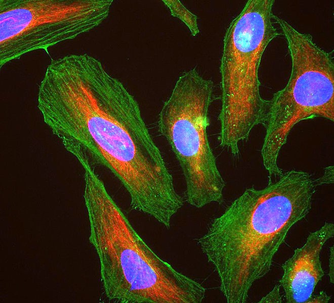 A microscopic close-up of cells fluorescently labeled in green for the cytoskeleton, blue for the nucleus, and red for cytoplasmic structures.

