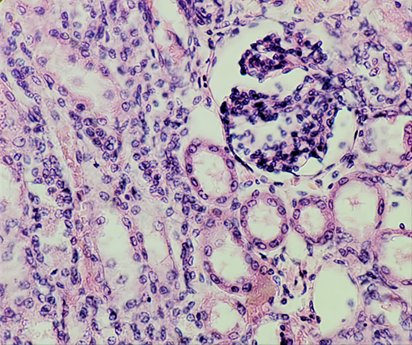 A histology section of the kidney stained with hematoxylin and eosin.