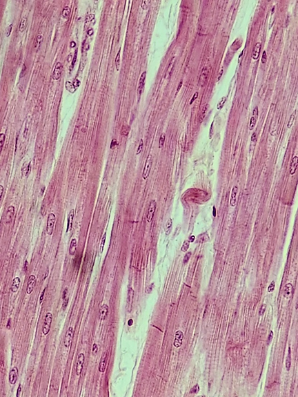 Cardiac muscle histology section imaged under the light microscope.