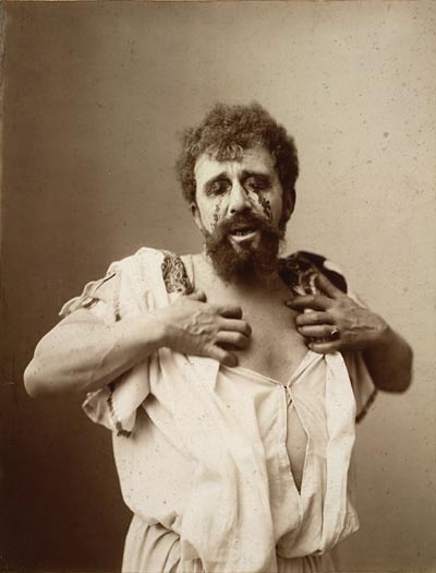 Oedipus | Oedipus displaying his injuries after the climax of his drama.