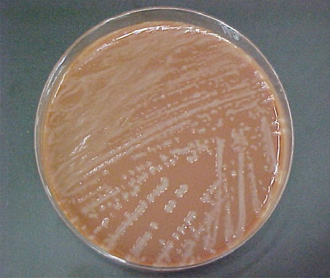 Haemophilus influenzae 10. Гемофилус инфлюэнце. Гемофилус агар. Haemophilus influenzae микробиология. Гемофильная палочка микробиология.