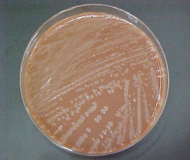 Haemophilus influenzae 10