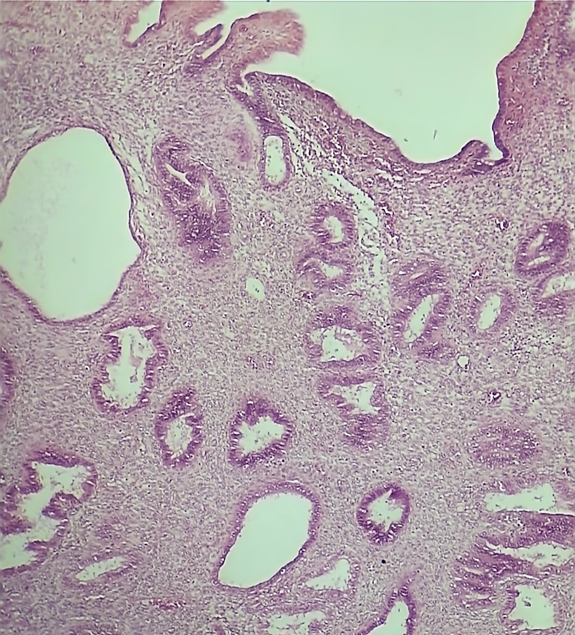 Histology image of the uterus in the luteal phase of the uterine cycle.