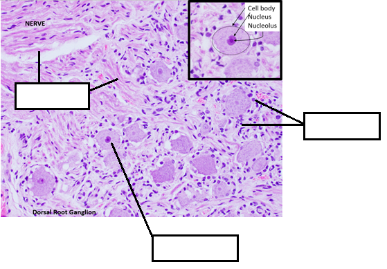 A microscope image of the anatomy of the spinal root ganglion with lines and blank spaces for the areas that need to be labeled and identified.