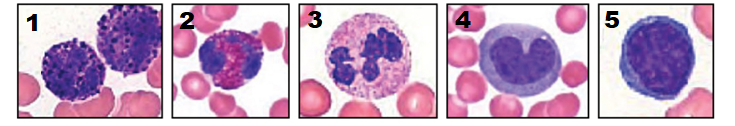 This image contain 5 separate photographs of white blood cells in a blood smear. Some red blood cells are seen in the background.
