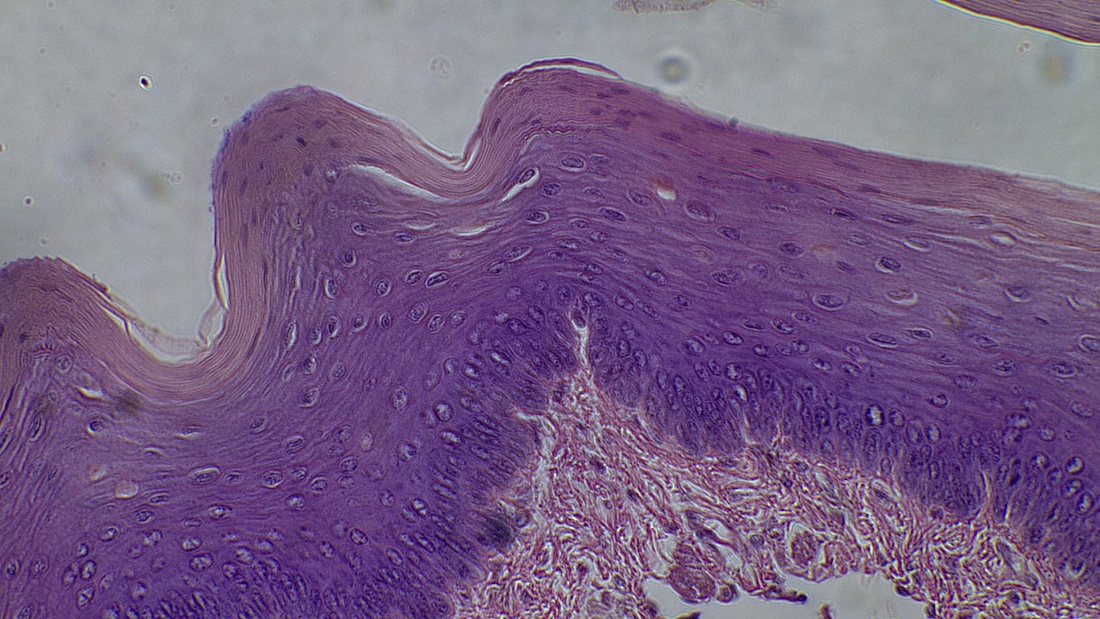 A microscope image of the stratified squamous cells of the epidermis and small amount of the connective tissue of the dermis.