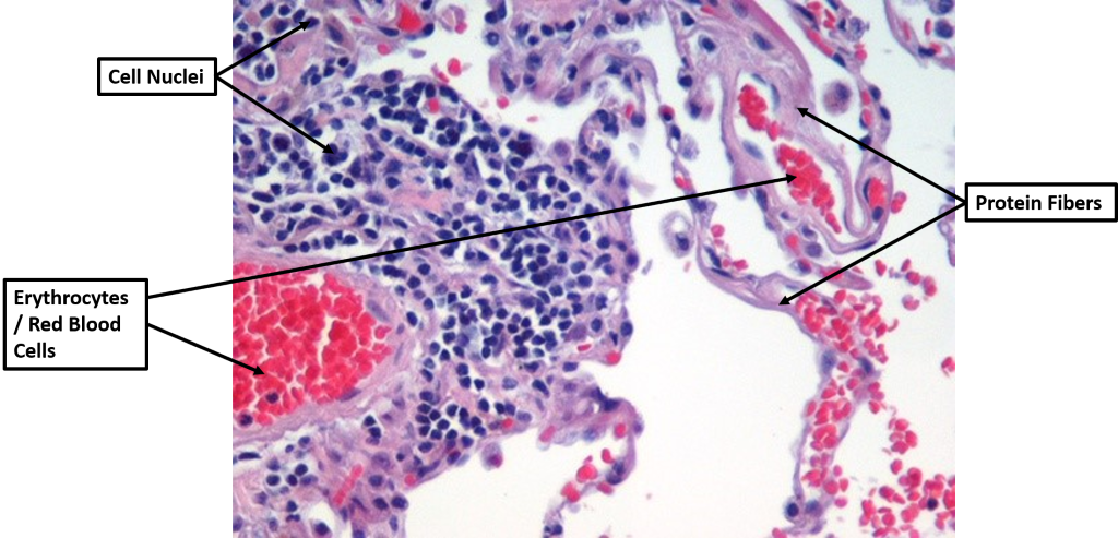 A microscope view of human lung tissue with arrows indicating the cell nuclei, blood cells, and protein fibers.