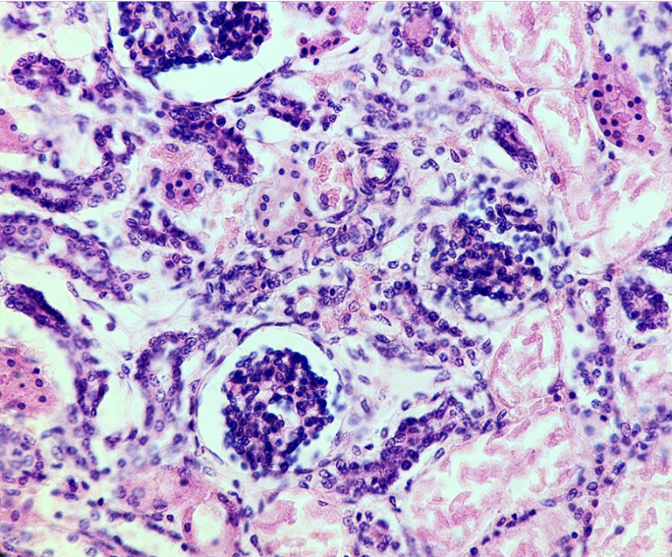 A histology image of the kidney stained with hematoxylin and eosin.